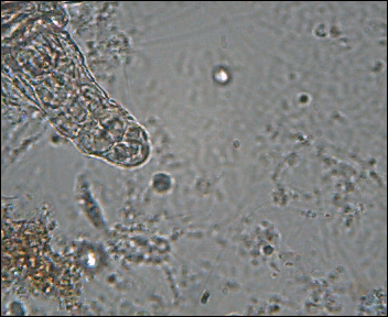 Hidden Parasites
